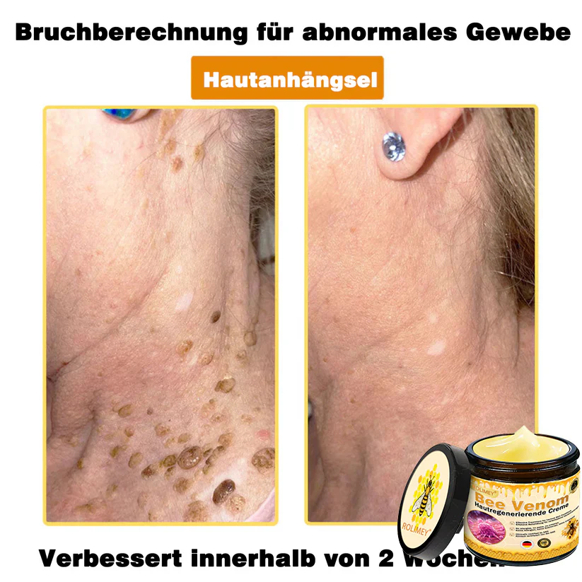 Vorschaubild 14