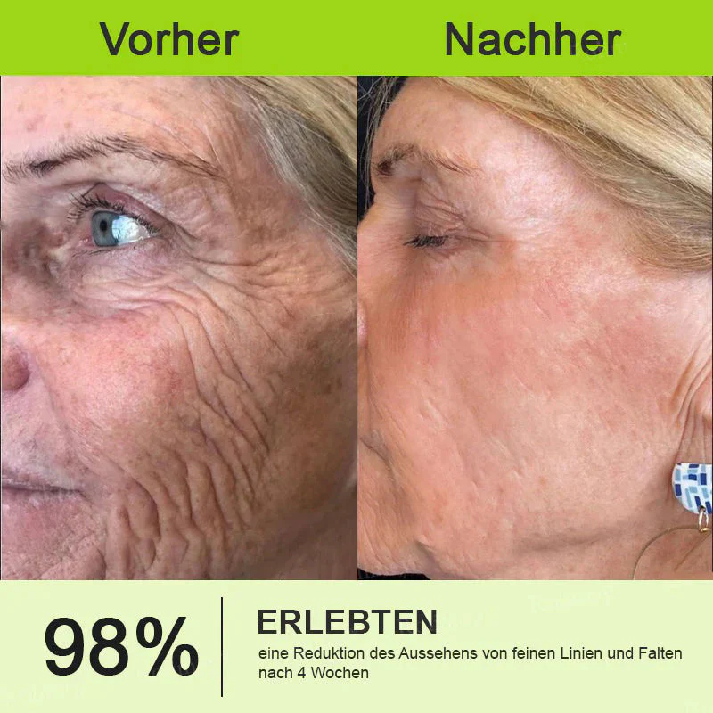 Vorschaubild 14